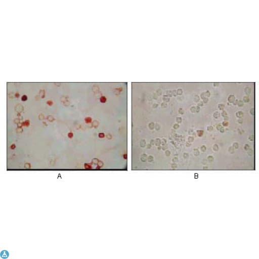 HHV-8 ORF62 Antibody