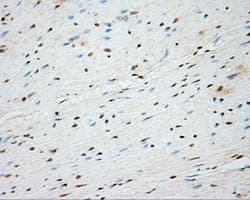 BTK Antibody (clone OTI15G8)
