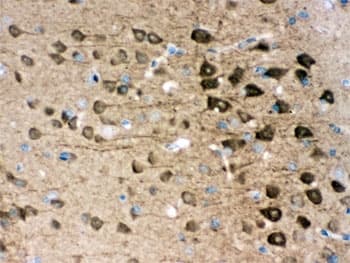 UCHL1 / PGP9.5 Antibody