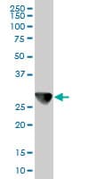 IHC-plus™ CAPZB / CAPZ Beta Antibody (clone 1H1)