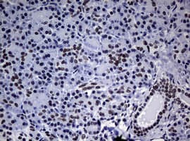NBN / Nibrin Antibody (aa183-460, clone OTI3C12, Carrier-free)