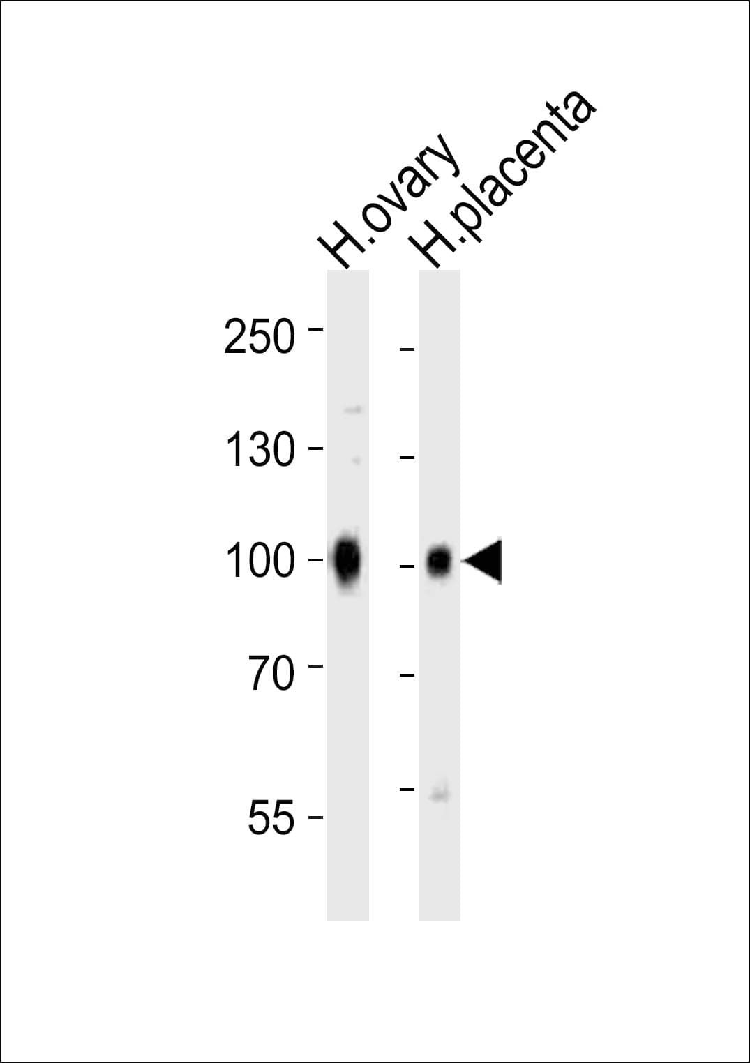 Polyclonal Rabbit anti-Human CD105 Antibody (aa554-587, WB)