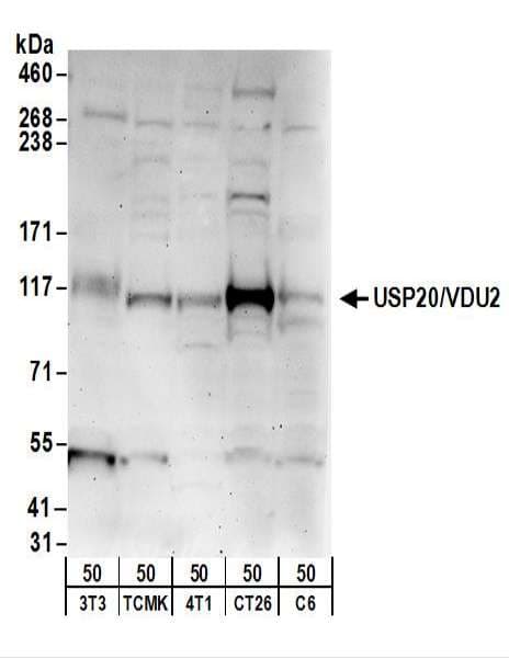 Polyclonal Rabbit anti-Human USP20 / VDU2 Antibody (aa863-913, WB)