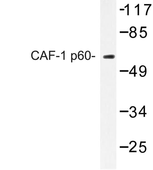 Polyclonal Rabbit anti-Human CHAF1B / CAF1 Antibody (Trp93, IHC, IF, WB)