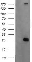 CMPK / CMPK1 Antibody (clone OTI1A9)