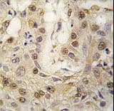 Polyclonal Rabbit anti-Human PRKG2 / CGKII Antibody (aa714-744, IHC, WB)