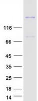 Human ADAMTS13 Protein (Recombinant Myc-DDK (Flag))