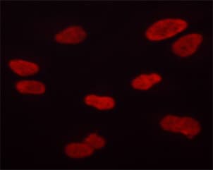 AURKB / Aurora-B Antibody (phospho-Thr232)