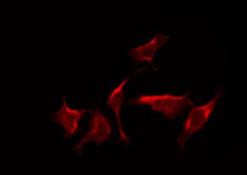 DYRK4 Antibody