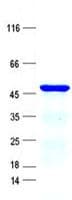 Human ECSIT Protein (Recombinant His, N-Terminal)