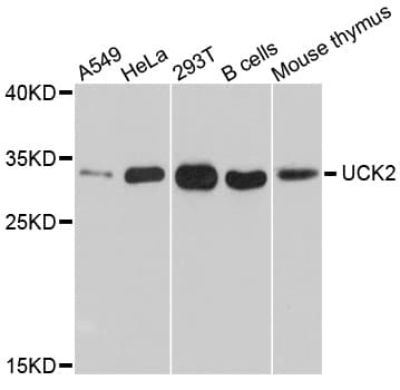 UCK2 Antibody