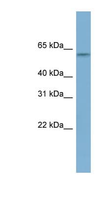 Polyclonal Rabbit anti-Human MYBPH Antibody (aa107-156, WB)