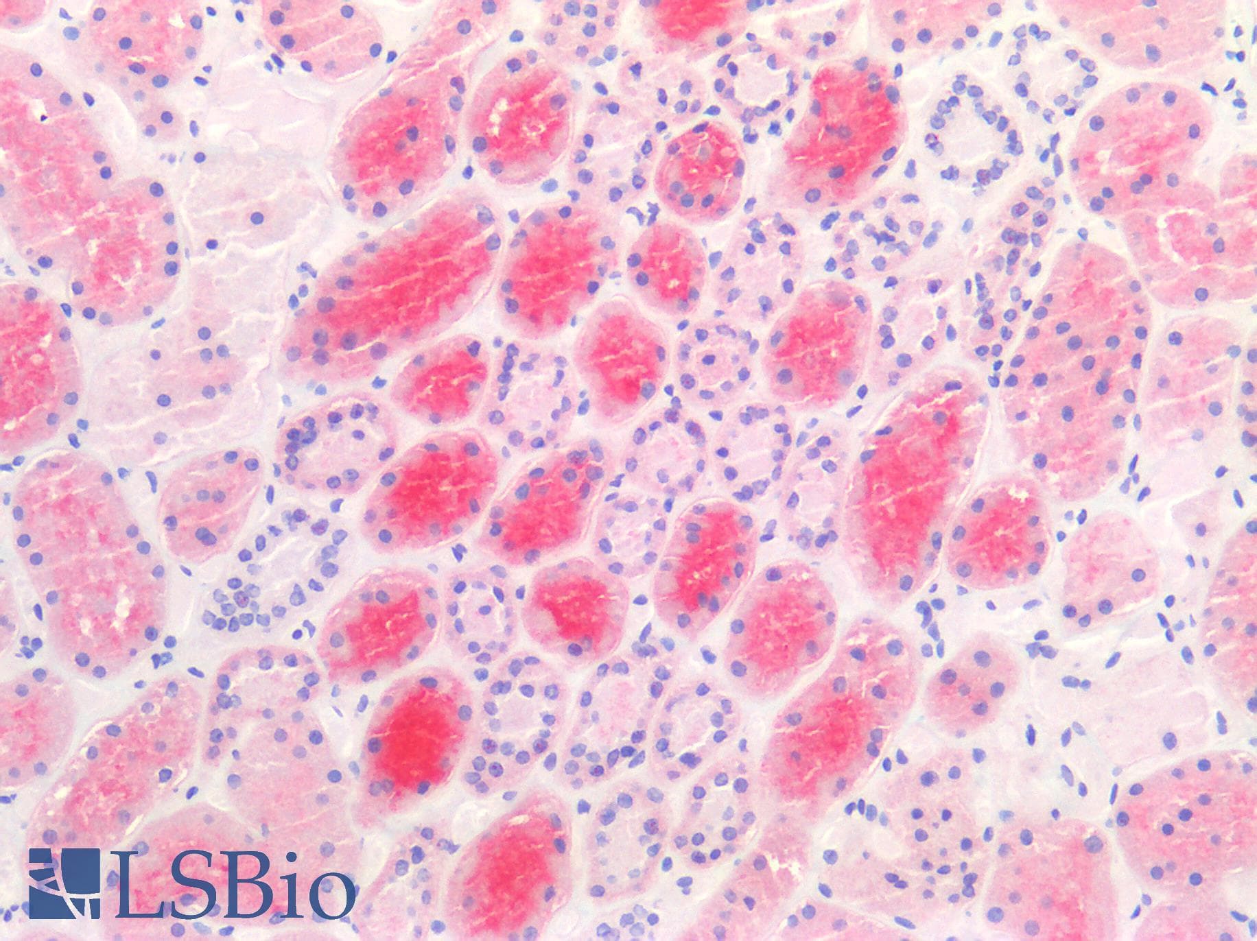 IHC-plus™ ACE2 / ACE-2 Antibody (aa773-805)