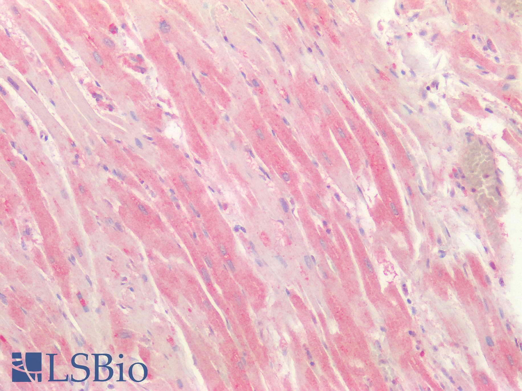 IHC-plus™ CTSK / Cathepsin K Antibody