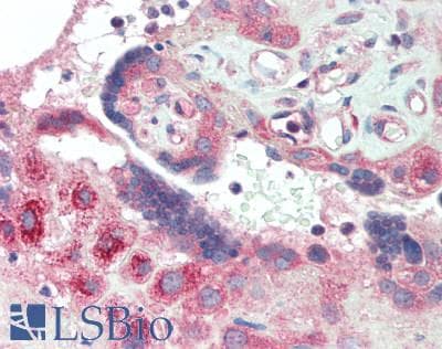 Polyclonal Rabbit anti-Mouse TRAF1 Antibody (aa169-392, IHC, WB)