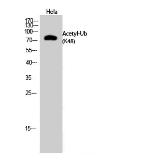 Ubiquitin Antibody (around the acetylation site of K48.)