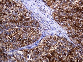 Monoclonal Mouse anti-Human POGK Antibody (clone OTI3E2, IHC, WB)