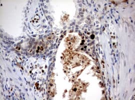 MKI67 / Ki67 Antibody (aa1160-1493, clone OTI5E6)