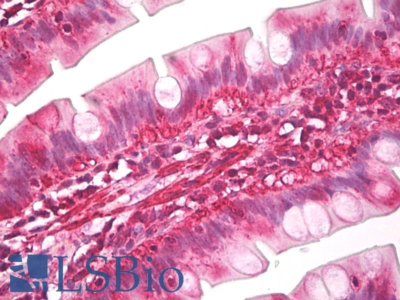 IHC-plus™ Latexin / MUM Antibody (aa200-250)