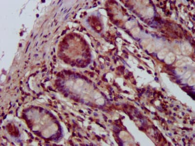 Polyclonal Rabbit anti-Human SHPRH Antibody (IHC, IF)