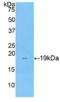 COL8A1 / Collagen VIII Alpha 1 Antibody (aa590-744, HRP)