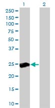 IHC-plus™ RALB Antibody (clone 4D1)