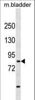 Polyclonal Rabbit anti-Human TBR1 Antibody (aa52-80, WB)