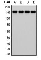 Polyclonal Rabbit anti-Human DIAPH1 Antibody (IHC, WB)
