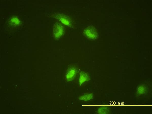 SLBP Antibody (clone 2C4-1C8)
