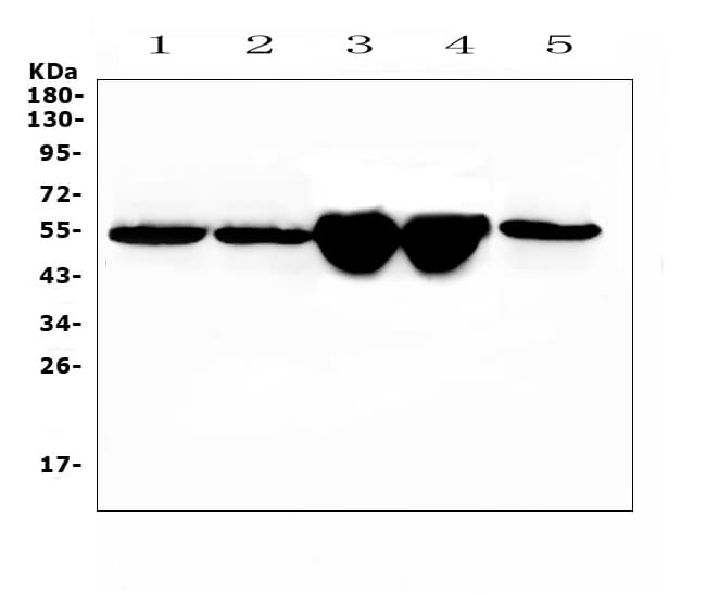 Polyclonal Rabbit anti-Mouse GC / Vitamin D-Binding Protein Antibody (WB)