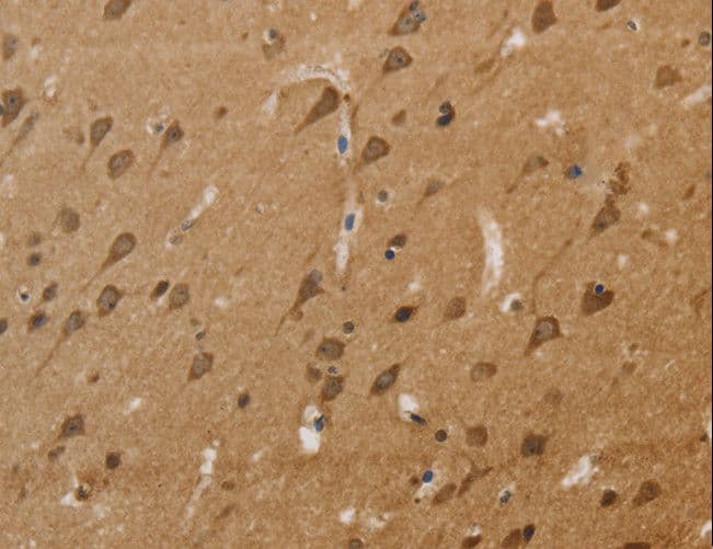 KCNN4 / KCa3.1 Antibody