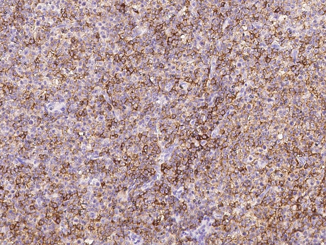 MME / CD10 Antibody (aa52-750, Preservative Free)