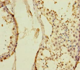 Polyclonal Rabbit anti-Human KIZ / PLK1S1 Antibody (IHC, WB)