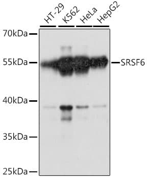 SRSF6 / SRP55 Antibody
