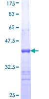 Human SPAM1 / PH20 Protein (Recombinant GST, N-terminus)