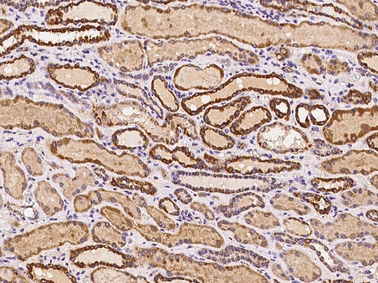 Polyclonal Rabbit anti-Human IBA57 / C1orf69 Antibody (IHC)