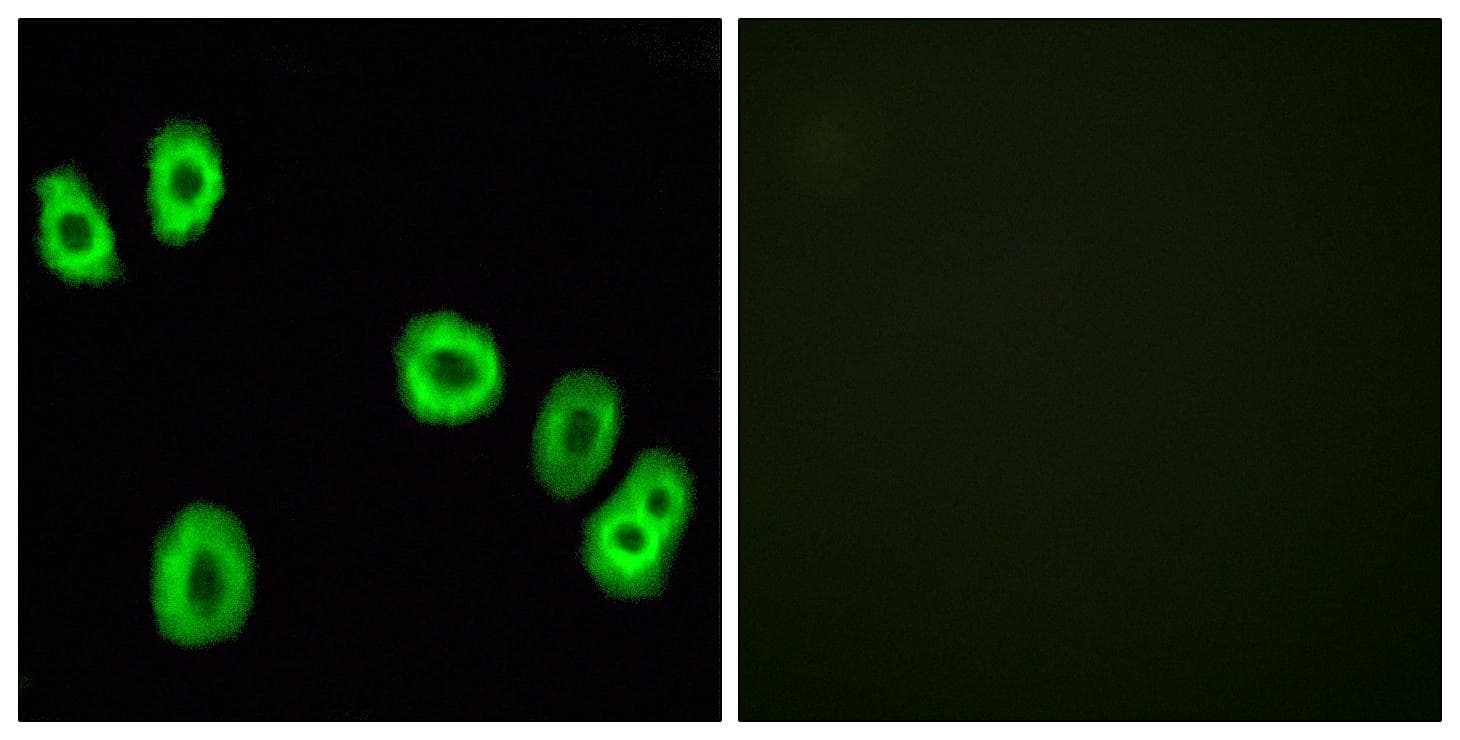 GPCRW / GPR18 Antibody