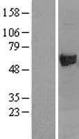 ASNS Protein (Over-Expression Lysate Myc-DDK (Flag))