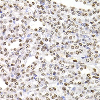 Polyclonal Rabbit anti-Human SOX5 Antibody (aa1-120, IHC, IF, WB)