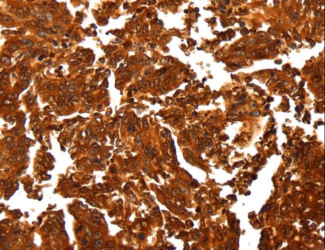 Polyclonal Rabbit anti-Human ALDOA / Aldolase A Antibody (IHC, WB)