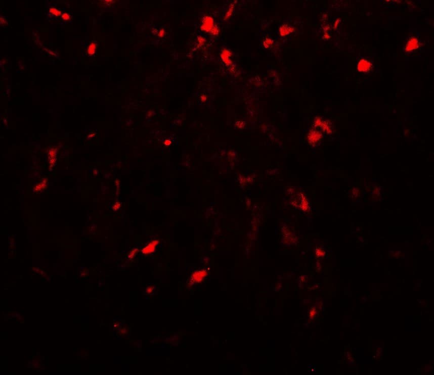 IHC-plus™ Polyclonal Rabbit anti-Human RPSA / Laminin Receptor Antibody (IHC, IF, WB)