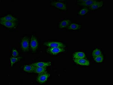SLPI / Antileukoproteinase Antibody