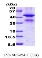 Human GCAT Protein (Recombinant His)