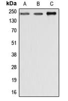 Polyclonal Rabbit anti-Human Dysferlin Antibody (C-Terminus, IHC, WB)
