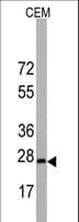 BARX1 Antibody (aa213-243)