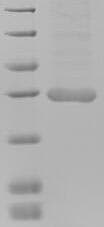 Human METRNL Protein (Recombinant 6His, N-terminus)