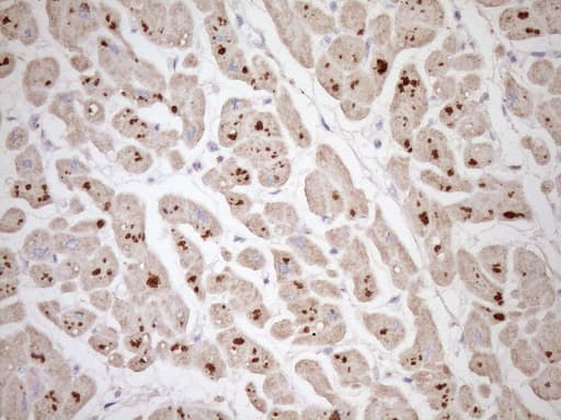 Monoclonal Mouse anti-Human TCAP / Telethonin Antibody (clone OTI3E7, IHC, WB)