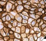 Monoclonal Mouse anti-Human ERBB2 / HER2 Antibody (Ready-to-Use, IHC)