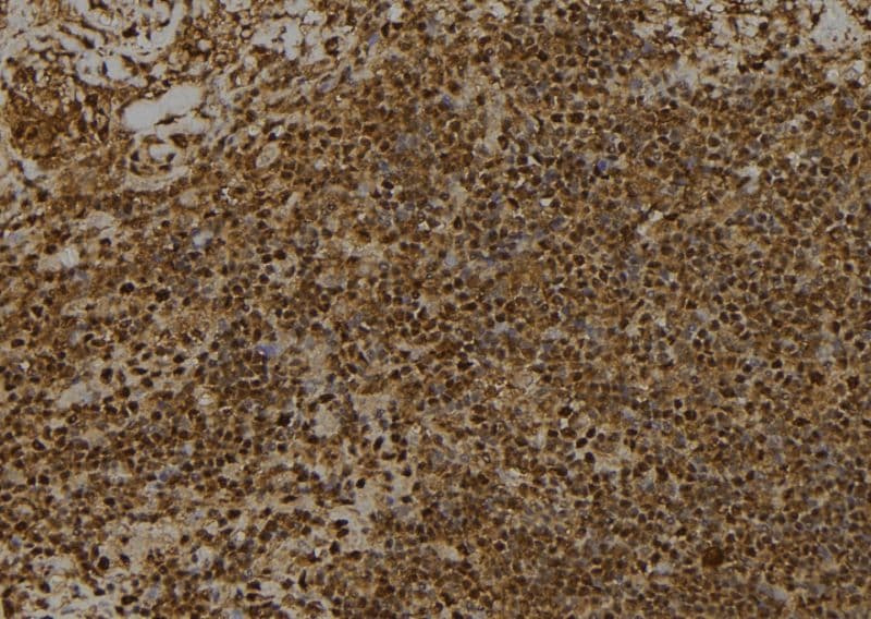 RPS6KA1 / RSK1 Antibody (phospho-Thr359,pSer363)