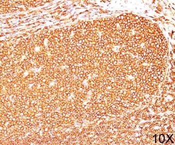 CD45RB Antibody (clone PD7/26, Ready-to-Use)